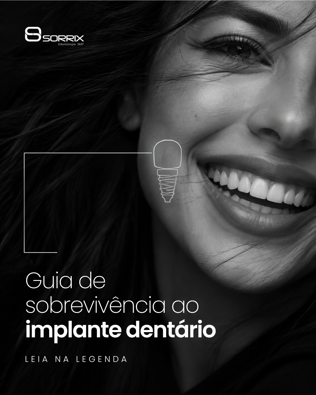 Sorrix Unidades · Design de post 02